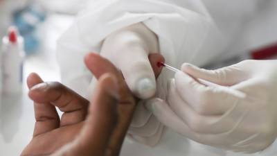 Число случаев коронавируса в Бразилии достигло 6 314 740