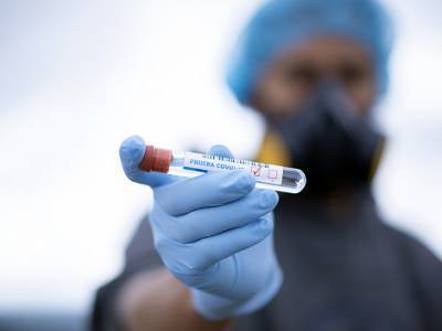 Роспотребнадзор напомнил о правилах сдачи теста на коронавирус