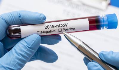 "Инвитро": тесты на коронавирус теперь можно сделать самому и не выходя из дома