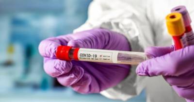 В декабре суточное количество новых случаев COVID-19 может достичь 20 тыс, - исследование КПИ