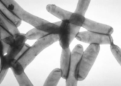В Праге в водопроводной воде обнаружили бактерии легионеллы