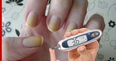 "Странную" проблему с ногтями назвали ранним признаком сахарного диабета