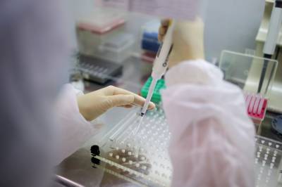 Минздрав: Украина начала закупать тесты на антиген для COVID-19