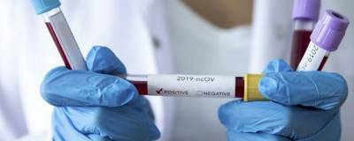 176 инфицированных коронавирусом выявлено в Пермском крае за последние сутки