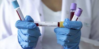 Германия и США установили новые рекорды по суточному приросту заболевших коронавирусом