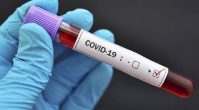 В мире зафиксирован новый антирекорд по коронавирусу