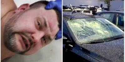Соцсети: в Киеве ловили голого мужчину, который разбил несколько машин и вломился в закрытый ТЦ — видео