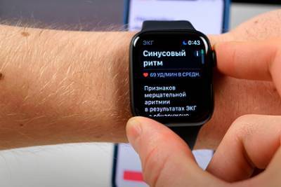 Apple запустила ЭКГ на часах в России
