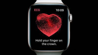 Россиянам включили функцию ЭКГ на Apple Watch