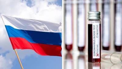 В России выявили 20 498 новых случаев COVID-19