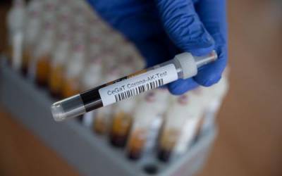 В России за сутки скончались 256 пациентов с коронавирусом