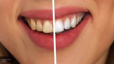 Стоматологи заявили об опасности советов по отбеливанию зубов из TikTok