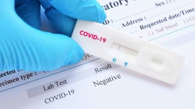 Кабмин выделил средства на закупку тестов на антитела к COVID-19