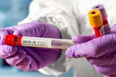 Инфекционист объяснил, как массовое тестирование на COVID-19 может сдержать эпидемию и почему локдаун не поможет