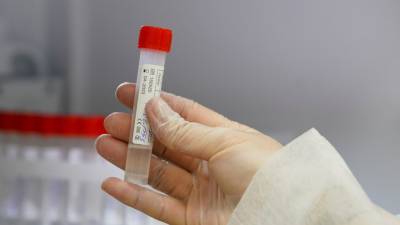 Более 81 млн тестов на коронавирус проведено в России