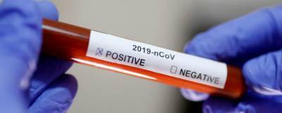 Еще 499 человек в Нижегородской области заразились коронавирусом