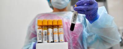 В Свердловской области выявлены еще 402 заразившихся коронавирусом