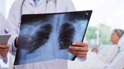 Туберкулезом болеют только бездомные: опровергаем самые распространенные мифы о здоровье легких