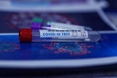 Минздрав оценил эффективность теста на CОVID-19 в домашних условиях