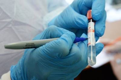 Более 23 тысяч случаев заражения коронавирусом выявили в Забайкалье с начала пандемии