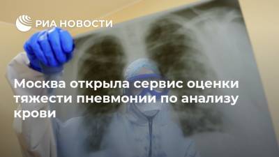 Москва открыла сервис оценки тяжести пневмонии по анализу крови