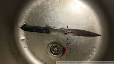 Шумный житель Пятигорска ножом ранил двух полицейских