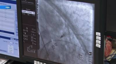 В Уфе впервые провели кардиооперацию с использованием отечественного импланта