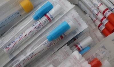 В Пермском крае выявили более трехсот новых случаев коронавируса