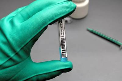 В ЛНР за сутки зарегистрировано 9 новых случаев коронавируса