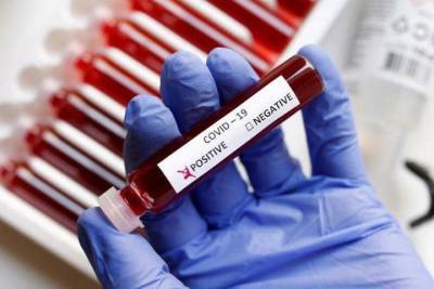 В Чувашии побит очередной суточный рекорд по заболевшим коронавирусом — 133