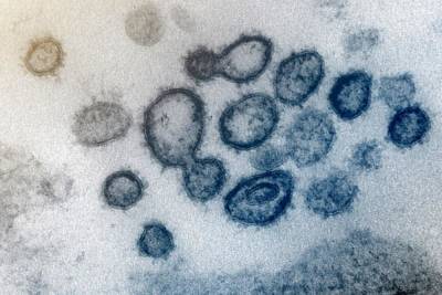Действительно ли коронавирус опаснее гриппа: масштабное исследование