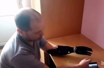 Два жителя Удмуртии получили бионические руки (ВИДЕО)