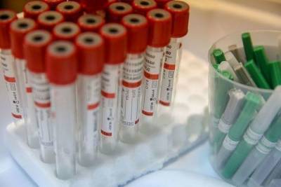 Число умерших от коронавируса в Чувашии достигло 400
