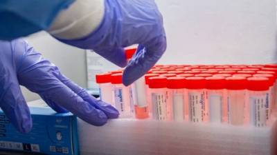 Сводка минздрава: количество больных коронавирусом в 30 городах Израиля