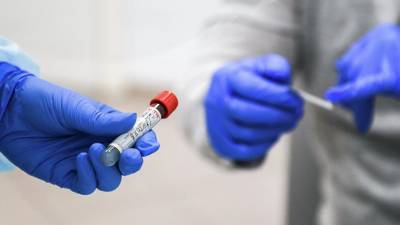 В Подмосковье провели более 1 млн тестов на антитела к коронавирусу