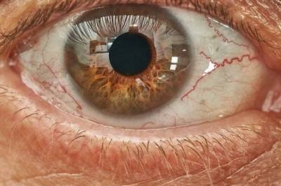 Ученые рассказали о случаях потери зрения после коронавируса