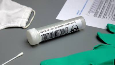 Первый российский экспресс-тест на коронавирус одобрен к применению