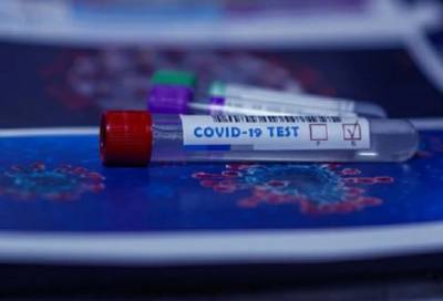 Более 28 тысяч человек в Петербурге сдали тест на коронавирус за минувшие сутки