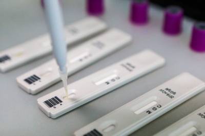 Степанов: На этой неделе Минздрав ожидает поставку в Украину 1,5 миллиона тестов на антиген