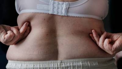 Исследователи назвали гормон, который способен победить ожирение
