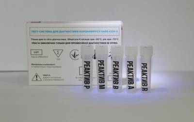 В Украине разработан тест для одновременного определения COVID-19 и гриппа