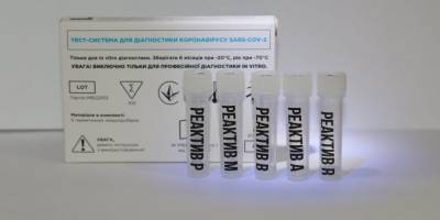 Три в одном: украинские ученые разработали тест для выявления COVID-19 и двух штаммов гриппа