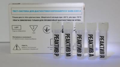 Одновременно определяет COVID-19 и грипп: Украинские ученые создали новый ПЦР-тест