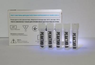 Украина разработала комбинированный ПЦР-тест для выявления COVID и гриппа