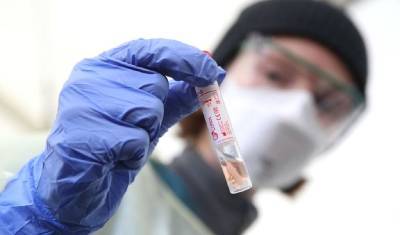 Инфекционист: коронавирус станет заразнее через пять лет