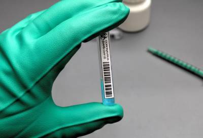 Более 31 тысячи человек в Петербурге сдали тест на коронавирус за минувшие сутки