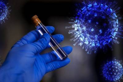 Еще 8 человек с коронавирусом умерли в Чувашии