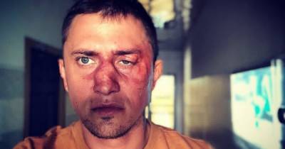 В Калининграде возбудили уголовное дело после избиения Прилучного в клубе