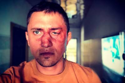 МВД возбудило дело об избиении актера Прилучного