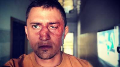 После избиения Павла Прилучного в Калининграде завели дело